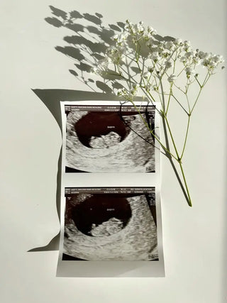 8tavo Mes de Embarazo (Semana 32 a 35)